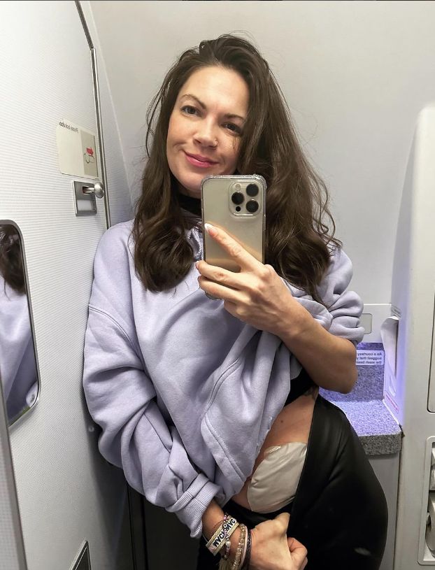 Flying with an Ostomy?  Yeah, You Absolutely Can.